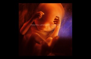 24 weeks